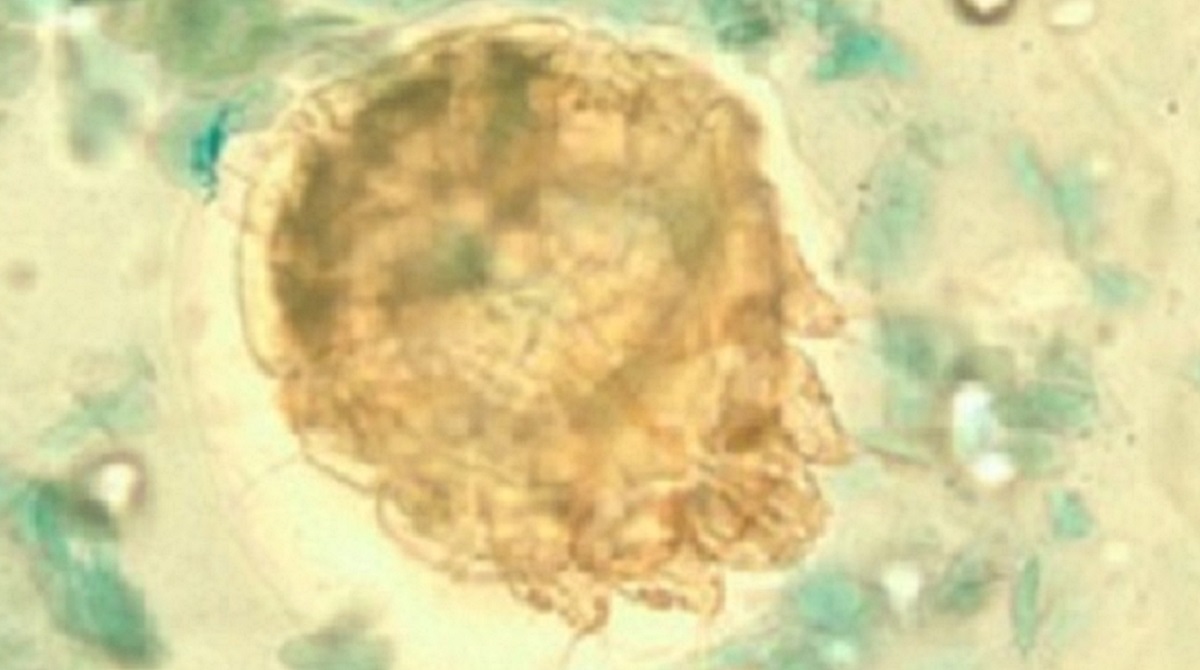 CDC